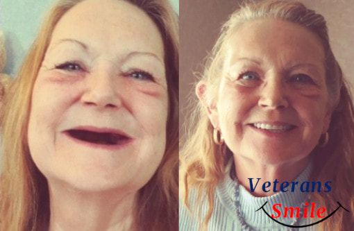 Victories - Veterans Smile